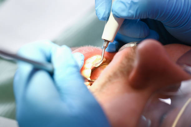 Best Urgent Tooth Repair  in Bluffdale, UT