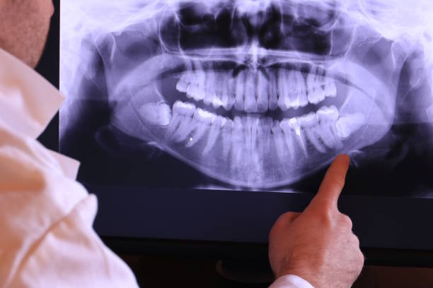 Best Dentist for Tooth Abscess  in Bluffdale, UT